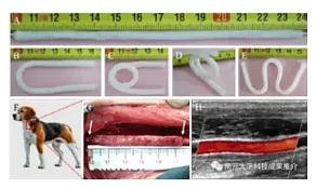 聚合物纤维骨架与脱细胞基质构成的杂化血管材料